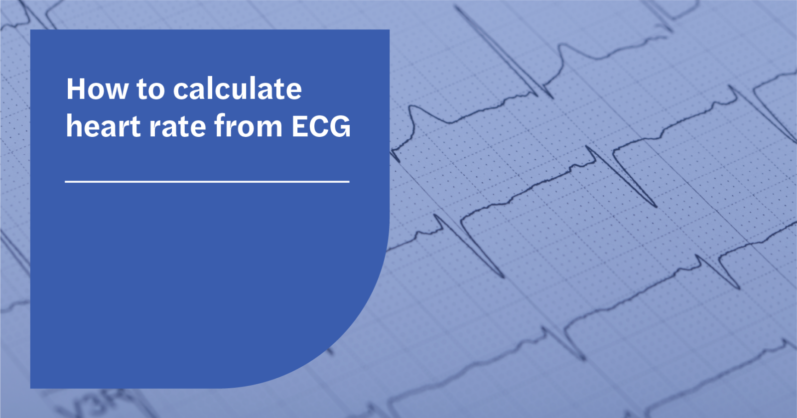 how-to-calculate-heart-rate-from-ecg-seer-medical-au