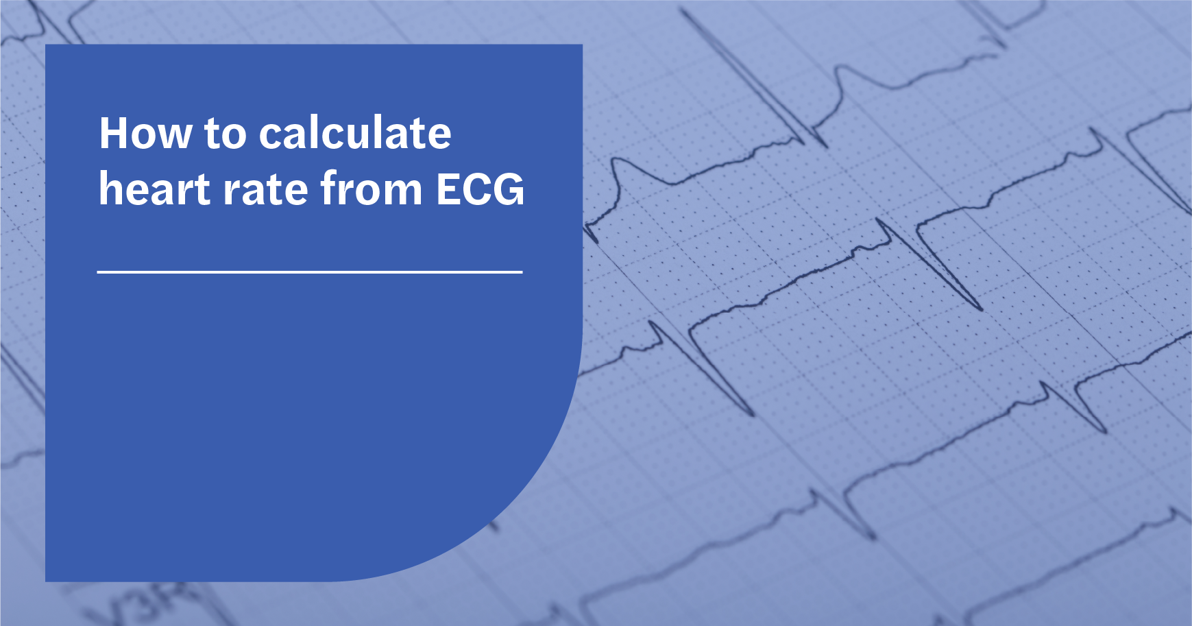 How to calculate heart rate from ECG (or EKG) - Seer Medical