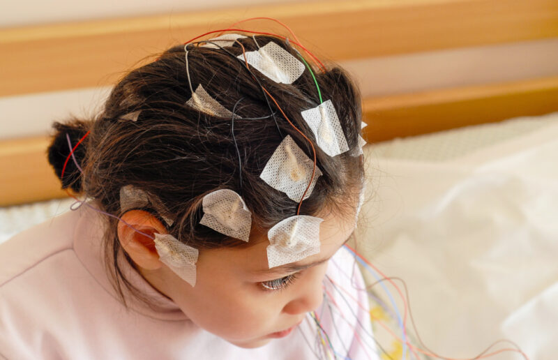 Child with EEG electrodes attached to her head