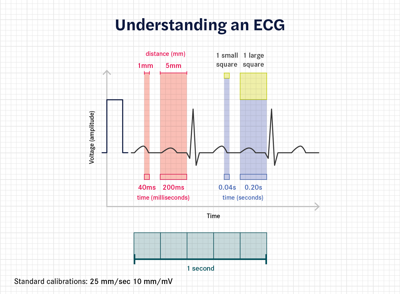 Can Ecg Be Used To Calculate Heart Rate