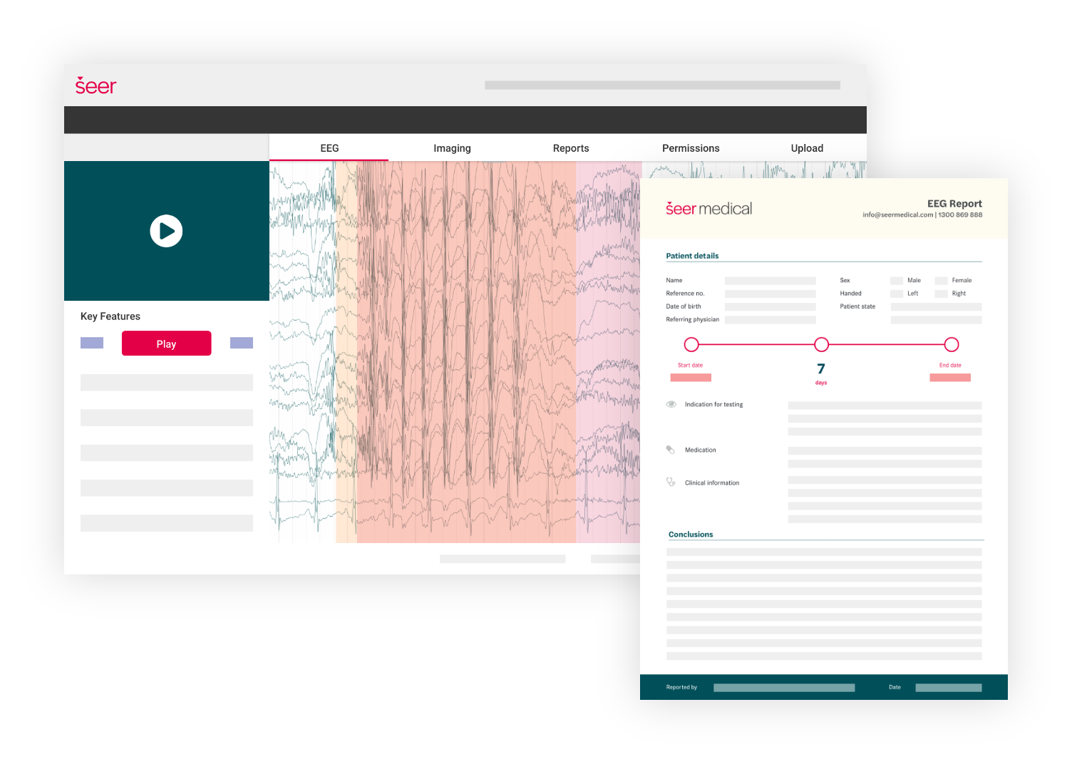 Screengrab of EEG data and report